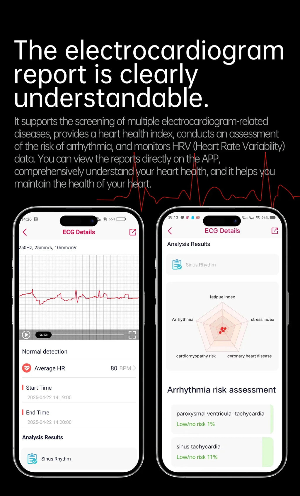 Blood Pressure Smart Watch