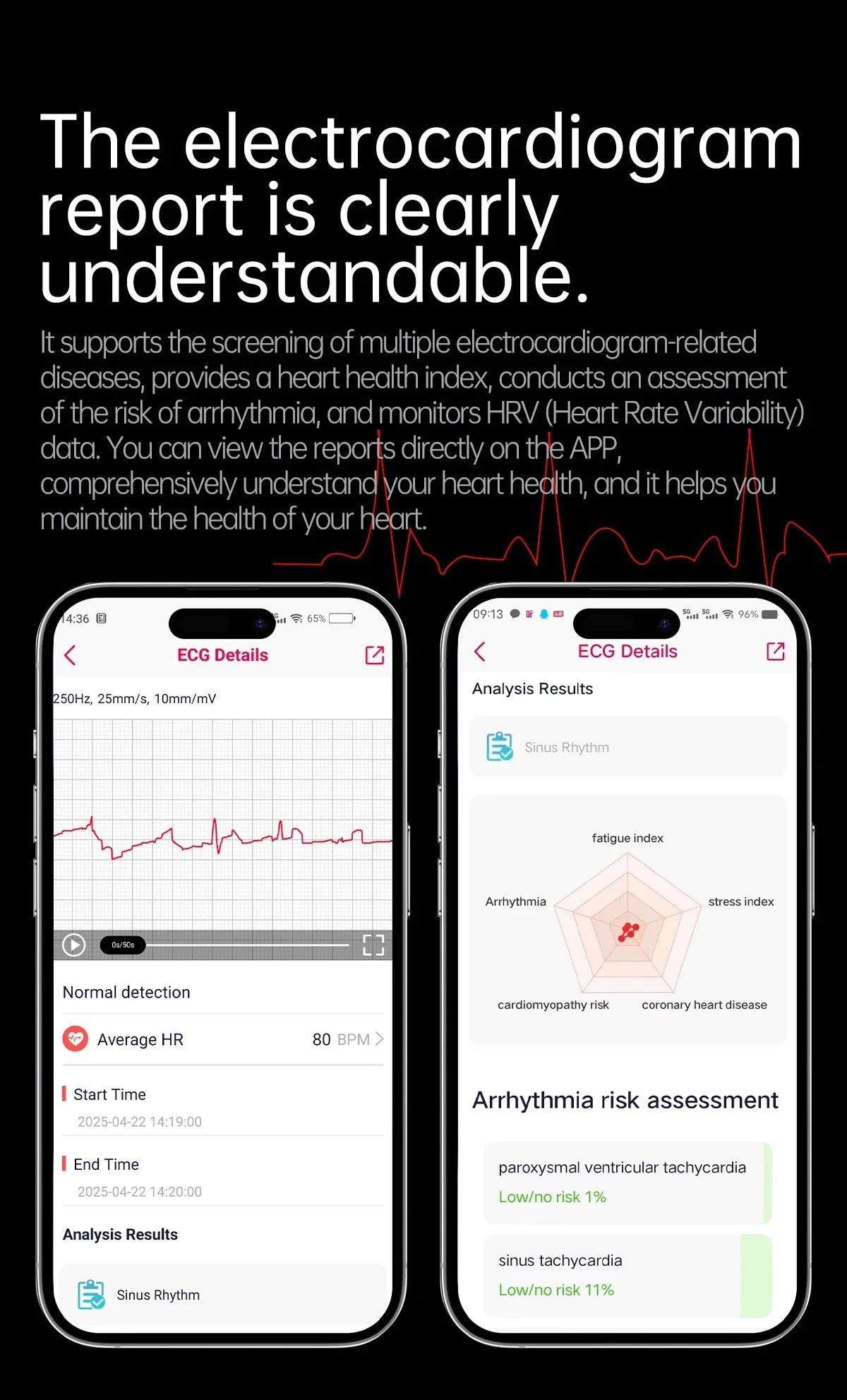 Blood Pressure Smart Watch