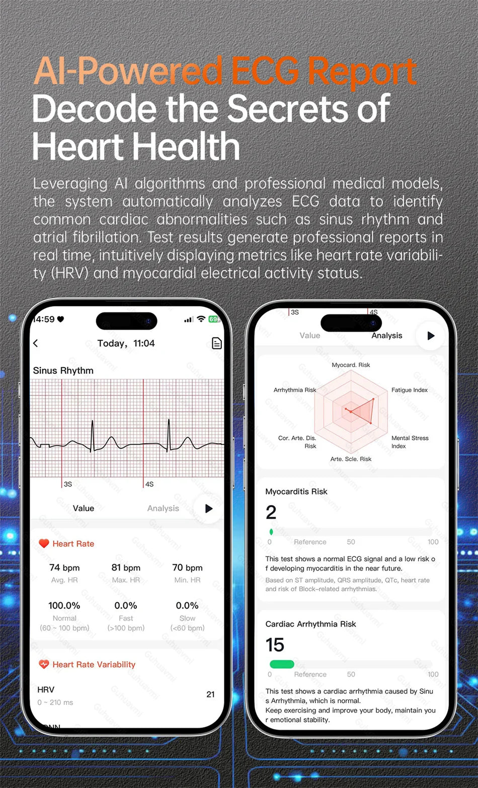 Health managed Smart Watch